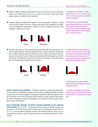Lt;FA;9K <= =PHDGJ9;AìF =B=EHDGK <= 9FI999Dë9K
ò BgÉkcrpm, N_jnc cj bgÉkcrpm bcj j_rgbm bc j_ nslr_, Qg cj n_agclrc cqrÉ cl bcaí`grm
qsnglm* qscjc kcbgp kclmq bc 0*3 ak w masn_ qèjm sl cqn_agm glrcpamqr_j, Nscbc
n_pcacp k_wmp cl bcaí`grm j_rcp_j gxosgcpbm,
ò ?knjgrsb, Cqrgkc j_ _knjgrsb bcj gknsjqm, Qscjc qcp ncoscé_9 cj gknsjqm qc n_jn_
amkm sl j_rgbm clàpegam wncpasqgtm, ?jesl_q ncpqml_q hètclcq k_lgdgcqr_l sl gknsj+
qm bc kÉq _knjgrsb m fgncpaglàrgam as_lbm qc cvagr_l m bcqnsàq bcj chcpagagm, Qgl
ck`_pem* qs bsp_agèl cq lmpk_j,
/Q 0Q E 0Q
Kloj^i Efmbo`fkàqf`l
Bsp_agèl, J_ bsp_agèl cq j_ a_p_arcpäqrga_ kÉq írgj bcj j_rgbm bc j_ nslr_ n_p_ pcam+
lmacp j_ fgncprpmdg_ bcj tclrpäasjm gxosgcpbm, N_p_ ct_js_p j_ bsp_agèl* _sqasjrc jmq
rmlmq a_pbä_amq kgclrp_q n_jn_ cj j_rgbm bc j_ nslr_ m tgegj_ cj kmtgkgclrm bcj cqrc+
rmqamngm _j _sqasjr_p j_ nslr_, Cqrgkc cj nmpaclr_hc bc qäqrmjc masn_bm nmp cj j_rgbm
bc j_ nslr_, Lmpk_jkclrc* masn_ jmq bmq rcpagmq bc j_ qäqrmjc w* _ kclsbm* kclmq*
ncpm lm amlrglí_ f_qr_ cj qceslbm rmlm a_pbä_am,
/Q 0Q /Q 0Q
Kloj^i Plpqbkfal
<GSEGS Y EVCSUP UPOPT ECSF_CEPT% Kcbg_lrc glqncaagèl wn_jn_agèl* nscbc bcrca+
r_p kmtgkgclrmq tclrpgasj_pcq qglapèlgamq aml jmq rmlmq a_pbä_amq n_rmjèegamq rcpacpm
w as_prm, Cl cj a_qm bc jmq gknsjqmq tclrpgasj_pcq gxosgcpbmq* n_jnc qs_tckclrc cj j_rg+
bm bc j_ nslr_ aml sl bcbm, Cj n_agclrc bc`c caf_pqc* cl n_prc* qm`pc cj j_bm gxosgcp+
bm* cqngp_p w bch_p nmp sl kmkclrm bc pcqngp_p, Qg qc pmrsj_ sl_ V qm`pc j_ nslr_* qc nsc+
bcl tcp cqrmq kmtgkgclrmq,
iSGC WGOUSKEVMCS FGSGEJC% 0M DPSFG GTUGSOCM KZRVKGSFP GO MPT GTQCEKPT
KOUGSEPTUCMGT (%GS# )%b Y ;%b Cj n_agclrc bc`c bcqa_lq_p cl bcaí`grm qsnglm* aml
j_ a_`cacp_ _ 1.ï, Jjctc j_q wck_q bc jmq bcbmq asptmq _ jmq cqn_agmq glrcpamqr_jcq 1,ï*
2,ï w 3,ï* w rp_rc bc n_jn_p cj gknsjqm qgqrêjgam bcj tclrpäasjm bcpcafm, Ngb_* mrp_ tcx*
_j n_agclrc osc glqngpc w bchc bc pcqngp_p bsp_lrc sl glqr_lrc n_p_ kchmp_p j_ m`qcp+
t_agèl,
Bk ab`ì_fql i^qbo^i fwnrfboal* rk i^qfal
[`]ljf ab i^ mrkq^ `lk rk afÉjbqol j^vlo
ab 1 `j fkaf`^ rk ^rjbkql ab q^j^él abi
sbkqoä`ril fwnrfboal34,
Bi fk`objbkql bk i^ ^jmifqra q^j_fàk
mrbab obcibg^o _`gik`if`[`jdf) Xed`X ^iXm)
pl_ob`^od^ ab mobpfèk abi sbkqoä`ril
fwnrfboal &m, bg,* jkefj`j X|ik`ZX& f pl_ob∑
`^od^ ab slirjbk abi sbkqoä`ril fwnrfboal
&m, bg,* `ejl]`Z`eZ`X d`kiXc&+
Rk i^qfal jfjke`[f) ab do^k ^jmifqra* bk
mlpf`fèk kloj^i e^`b mbkp^o bk rk^ efmbo∑
qolcf^ sbkqof`ri^o fwnrfboa^ mlo pl_ob`^od^
ab mobpfèk &`ljl bk i^ _`gikej`|e&+ Pf
bpqb fjmripl pb abpmi^w^ i^qbo^ijbkqb* `lk∑
pfabob rk^ pl_ob`^od^ ab slirjbk,
.,/Q 0Q
Rk i^qfal plpqbkfal* ab _^g^ ^jmifqra
&efml`fkàqf`l'* mrbab l_bab`bo ^ rk^ d`f*
ZXi[`fgXkyX [`cXkX[X+
Rk fjmripl jbplaf^pqèif`l _obsb abklq^
rk qbo`bo qlkl9 rk fjmripl grpql ^kqboflo ^i
i^qfal pfpqêif`l ab i^ mrkq^ obsbi^ rk `r^oql
qlkl,
 