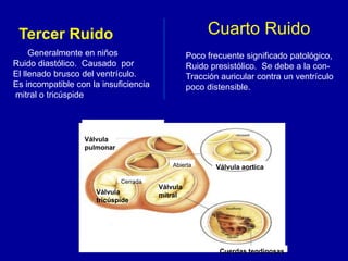Tercer Ruido 
Generalmente en niños 
Ruido diastólico. Causado por 
El llenado brusco del ventrículo. 
Es incompatible con la insuficiencia 
mitral o tricúspide. 
Cuarto Ruido 
Poco frecuente significado patológico, 
Ruido presistólico. Se debe a la con- 
Tracción auricular contra un ventrículo 
poco distensible. 
Válvula 
pulmonar 
Abierta Válvula aortica 
Válvula 
Cerrada 
Válvula mitral 
tricúspide 
Cuerdas tendinosas 
 