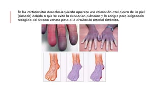 En los cortocircuitos derecha-izquierda aparece una coloración azul oscura de la piel
(cianosis) debido a que se evita la circulación pulmonar y la sangre poco oxigenada
recogida del sistema venoso pasa a la circulación arterial sistémica.
 