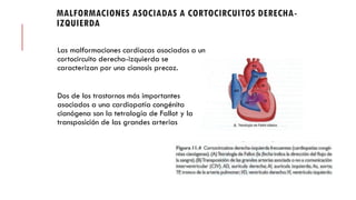 MALFORMACIONES ASOCIADAS A CORTOCIRCUITOS DERECHA-
IZQUIERDA
Las malformaciones cardíacas asociadas a un
cortocircuito derecha-izquierda se
caracterizan por una cianosis precoz.
Dos de los trastornos más importantes
asociados a una cardiopatía congénita
cianógena son la tetralogía de Fallot y la
transposición de las grandes arterias
 