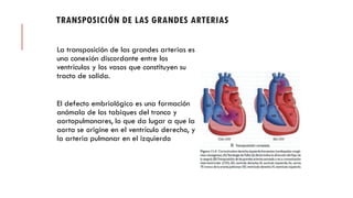 TRANSPOSICIÓN DE LAS GRANDES ARTERIAS
La transposición de las grandes arterias es
una conexión discordante entre los
ventrículos y los vasos que constituyen su
tracto de salida.
El defecto embriológico es una formación
anómala de los tabiques del tronco y
aortopulmonares, lo que da lugar a que la
aorta se origine en el ventrículo derecho, y
la arteria pulmonar en el izquierdo
 