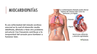 MIOCARDIOPATÍAS
Es una enfermedad del músculo cardíaco
anormal en la cual el miocardio resulta
debilitado, dilatado o tiene otro problema
estructural. Con frecuencia contribuye a la
incapacidad del corazón para bombear o
funcionar bien.
 