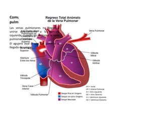 Comunicación venosa
pulmonar anómala total.
Las venas pulmonares no llegan a
unirse directamente a la aurícula
izquierda, cuando no se forma la vena
pulmonar común.
El agujero oval o una CIA permite la
llegada de sangre
 