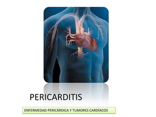 PERICARDITIS
ENFERMEDAD PERICÁRDICA Y TUMORES CARDÍACOS
 