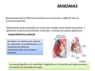 MIXOMAS

Aproximadamente el 90% esta localizado en las aurículas, el 80% de ellos en
la aurícula izquierda.

Mayormente están localizados en la fosa oval, pueden variar desde masa duras y
globulares hasta lesiones blandas, traslúcidas y vellosas de aspecto gelatinoso.
  CARACTERÍSTICAS CLÍNICAS

 Se deben a la obstrucción valvular
 en «péndulo» la embolización o un
 síndrome de síntomas
 constitucionales como fiebre y
 malestar.



   La ecocardiografía es la modalidad diagnóstica y la resección quirúrgica produce
   la curación en casi todos los casos.
 