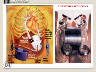 “Curso de Anatomía Humana:
 carrera de Médico Cirujano”


                               Corazones artificiales




                                                        32
 