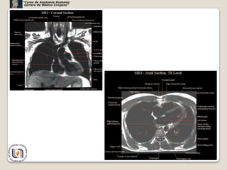 “Curso de Anatomía Humana:
 carrera de Médico Cirujano”




                               40
 