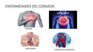 ENFERMEDADES DEL CORAZON
INFARTOS
MARCAPASOS
CARDIOPATIAS CONGENITAS
 