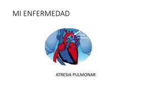 MI ENFERMEDAD
ATRESIA PULMONAR
 