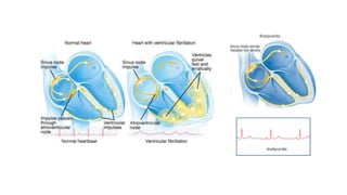 Corazón Sistema Cardionector