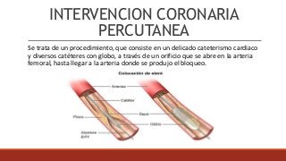 INTERVENCION CORONARIA
PERCUTANEA
Se trata de un procedimiento, que consiste en un delicado cateterismo cardiaco
y diversos catéteres con globo, a través de un orificio que se abre en la arteria
femoral, hasta llegar a la arteria donde se produjo el bloqueo.
 