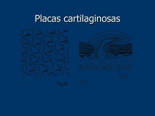 Placas cartilaginosas 