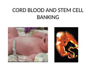 Cord Blood Banking And Stem Cell Banking Pptx