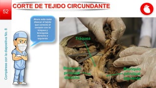 Bronquio
principal
izquierdo
52
Ahora solo resta
disecar el tejido
que conecta el
corazón con la
tráquea y
bronquios
derecho e
izquierdo
Bronquio
principal
derecho
Tráquea
Compárese
con
la
diapositiva
No.
8
 
