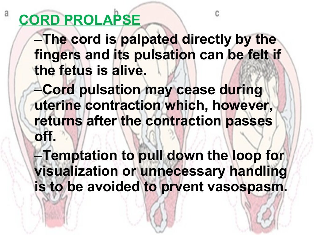 Cord prolapse