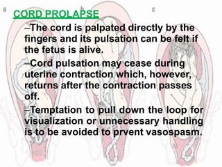 CORD PROLAPSE
–The cord is palpated directly by the
fingers and its pulsation can be felt if
the fetus is alive.
–Cord pulsation may cease during
uterine contraction which, however,
returns after the contraction passes
off.
–Temptation to pull down the loop for
visualization or unnecessary handling
is to be avoided to prvent vasospasm.
 