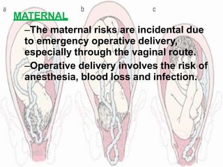 MATERNAL
–The maternal risks are incidental due
to emergency operative delivery,
especially through the vaginal route.
–Operative delivery involves the risk of
anesthesia, blood loss and infection.
 