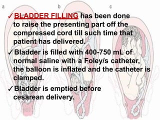 ✓BLADDER FILLING has been done
to raise the presenting part off the
compressed cord till such time that
patient has delivered.
✓Bladder is filled with 400-750 mL of
normal saline with a Foley/s catheter,
the balloon is inflated and the catheter is
clamped.
✓Bladder is emptied before
cesarean delivery.
 