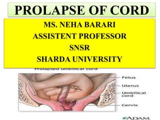 PROLAPSE OF CORD
MS. NEHA BARARI
ASSISTENT PROFESSOR
SNSR
SHARDA UNIVERSITY
 