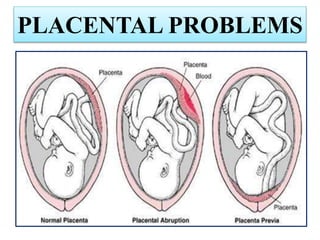PLACENTAL PROBLEMS
 
