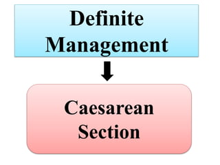 Definite
Management
Caesarean
Section
 