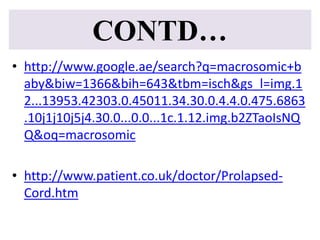 CONTD…
• http://www.google.ae/search?q=macrosomic+b
aby&biw=1366&bih=643&tbm=isch&gs_l=img.1
2...13953.42303.0.45011.34.30.0.4.4.0.475.6863
.10j1j10j5j4.30.0...0.0...1c.1.12.img.b2ZTaoIsNQ
Q&oq=macrosomic
• http://www.patient.co.uk/doctor/Prolapsed-
Cord.htm
 