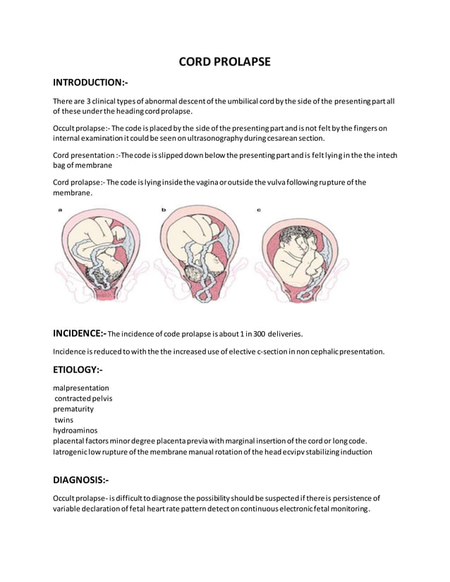 Cord prolapse