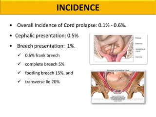 INCIDENCE
• Overall Incidence of Cord prolapse: 0.1% - 0.6%.
• Cephalic presentation: 0.5%
• Breech presentation: 1%.
 0.5% frank breech
 complete breech 5%
 footling breech 15%, and
 transverse lie 20%
 
