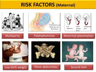 RISK FACTORS (Maternal)
Multiparity Polyhydramnios Abnormal placentation
Low birth weight Pelvic deformities Second twin
 
