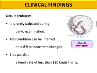 CLINICAL FINDINGS
Occult prolapse:
• It is rarely palpated during
pelvic examination.
• This condition can be inferred
only if fetal heart rate changes
• Bradycardia :
a heart rate of less than 120 beats/ mins.
 