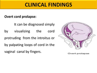 Overt cord prolapse:
It can be diagnosed simply
by visualizing the cord
protruding from the introitus or
by palpating loops of cord in the
vaginal canal by fingers.
CLINICAL FINDINGS
 