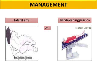 MANAGEMENT
OR
Lateral sims Trendelenburg position
 