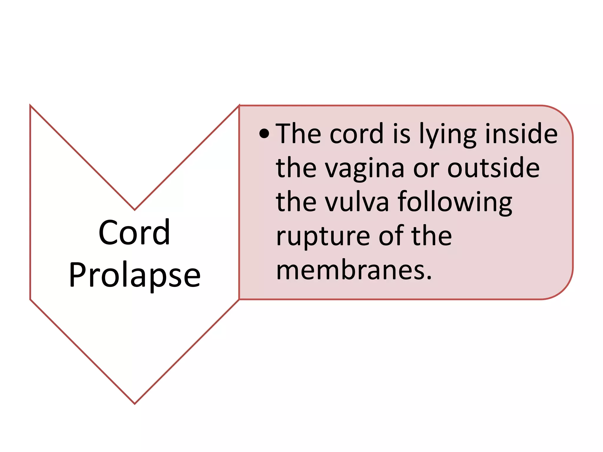 Cord prolapse sasi (2) | PPTX