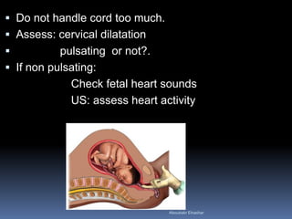  Do not handle cord too much.
 Assess: cervical dilatation
 pulsating or not?.
 If non pulsating:
Check fetal heart sounds
US: assess heart activity
Aboubakr Elnashar
 