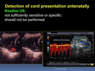 Detection of cord presentation antenatally
Routine US:
not sufficiently sensitive or specific:
should not be performed
Aboubakr Elnashar
 