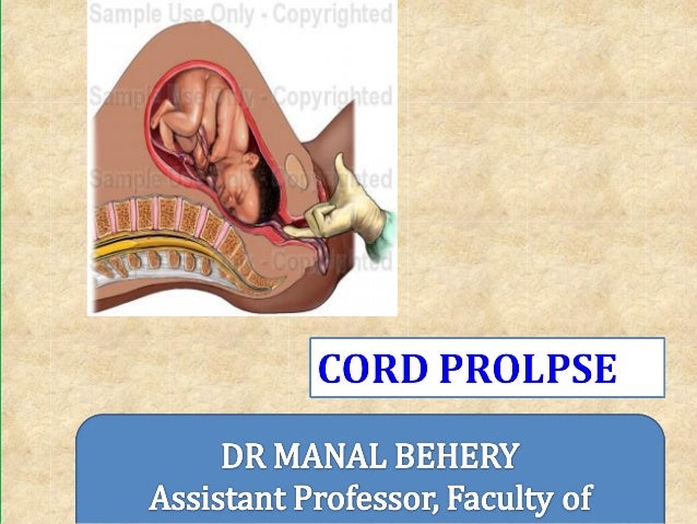 presentation of the cord definition