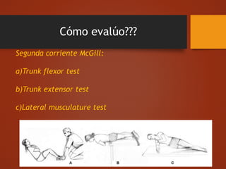 Cómo evalúo???
Segunda corriente McGill:
a)Trunk flexor test
b)Trunk extensor test
c)Lateral musculature test
 