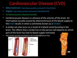Extent of and trends in CVD 
• Males are more likely to die from CVD then females 
• Death rates significantly increase wi...