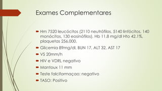 Exames Complementares
 Hm 7520 leucócitos (2110 neutrófilos, 5140 linfócitos, 140
monócitos, 130 eosinófilos), Hb 11.8 mg/dl Hto 42.1%,
plaquetas 256,000.
 Glicemia 89mg/dl, BUN 17, ALT 32, AST 17
 VS 20mm/h
 HIV e VDRL negativo
 Mantoux 11 mm
 Teste falciformaçao: negativo
 TASO: Positivo
 