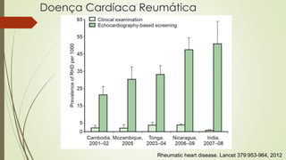 Doença Cardíaca Reumática
Rheumatic heart disease. Lancet 379:953-964, 2012
 