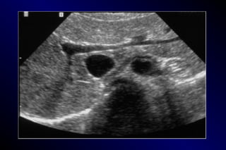 Normal Ab Flashpoint CORE CURRICULUM LECTURE 06 NORMAL ABDOMINAL VESSELS.part 1.1.ppt