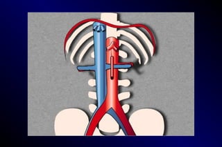 Normal Ab Flashpoint CORE CURRICULUM LECTURE 06 NORMAL ABDOMINAL VESSELS.part 1.1.ppt