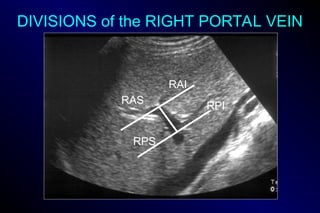 CORE CURRICULUM LECTURE 09 LIVER SEGMENTAL ANATOMY .ppt