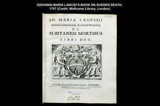 GIOVANNI MARIA LANCISI’S BOOK ON SUDDEN DEATH,
      1707 (Credit: Wellcome Library, London).
 