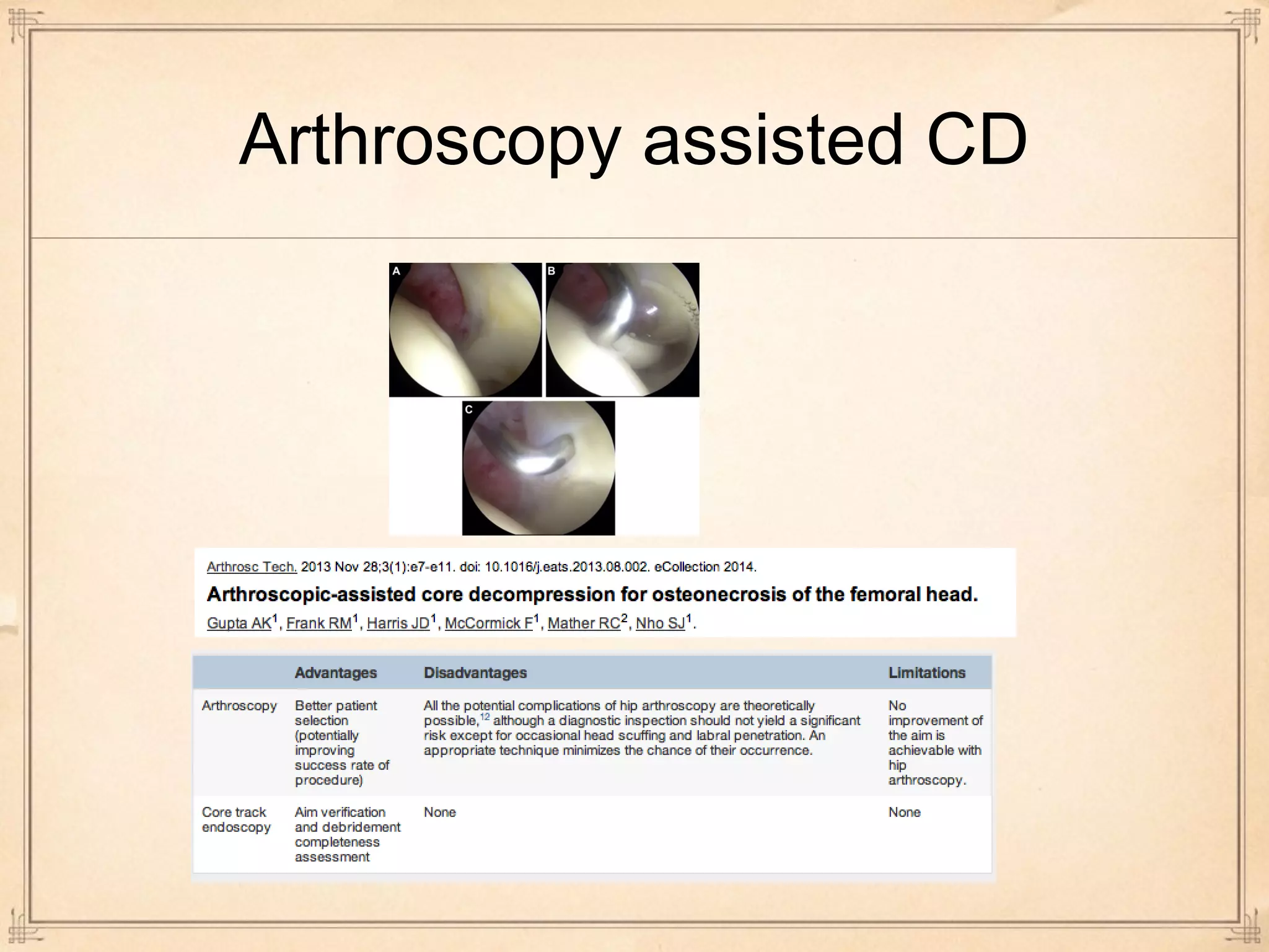 Arthroscopy assisted CD 
 