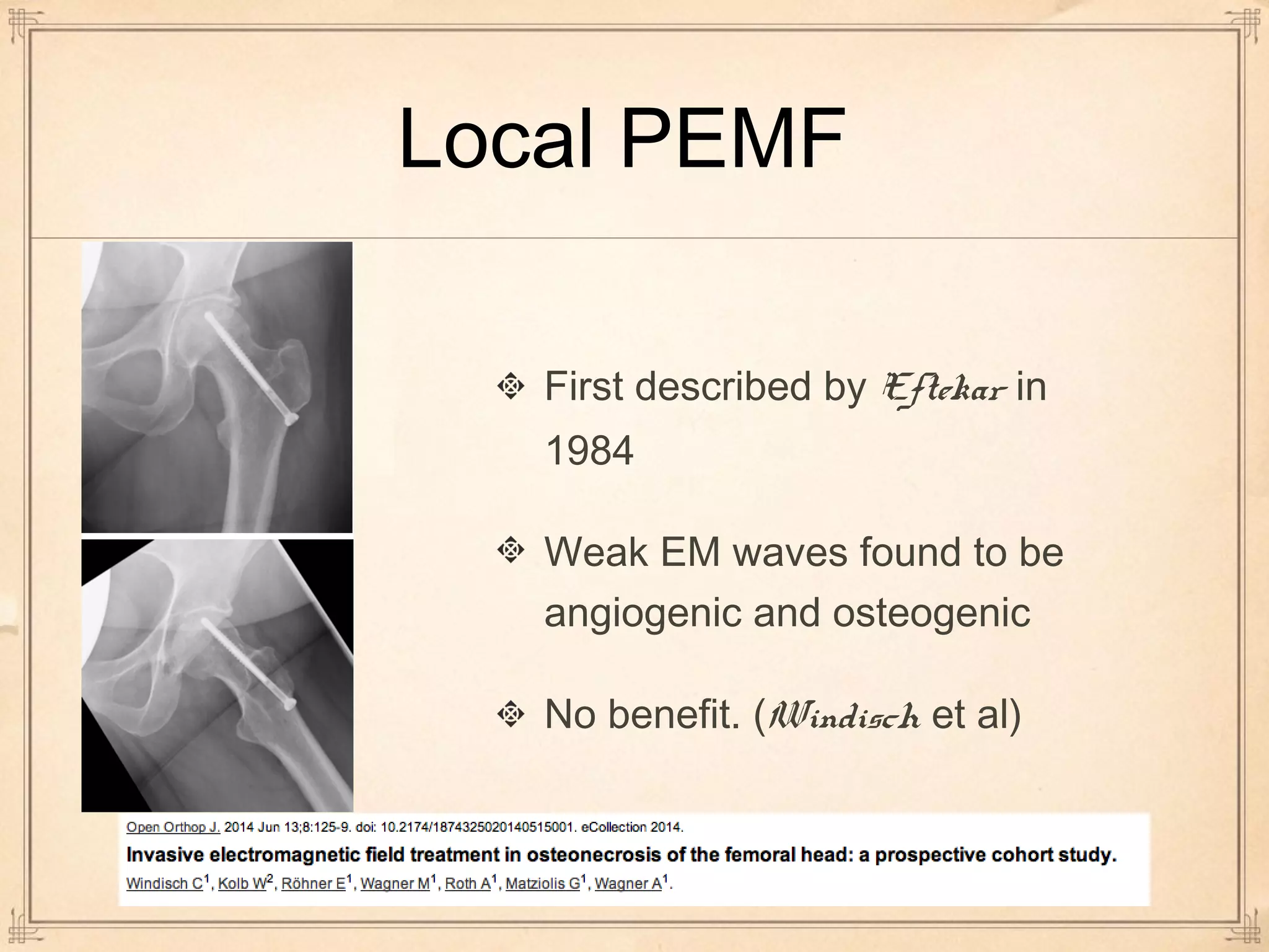 Local PEMF 
First described by Eftekar in 
1984 
Weak EM waves found to be 
angiogenic and osteogenic 
No benefit. (Windisch et al) 
 