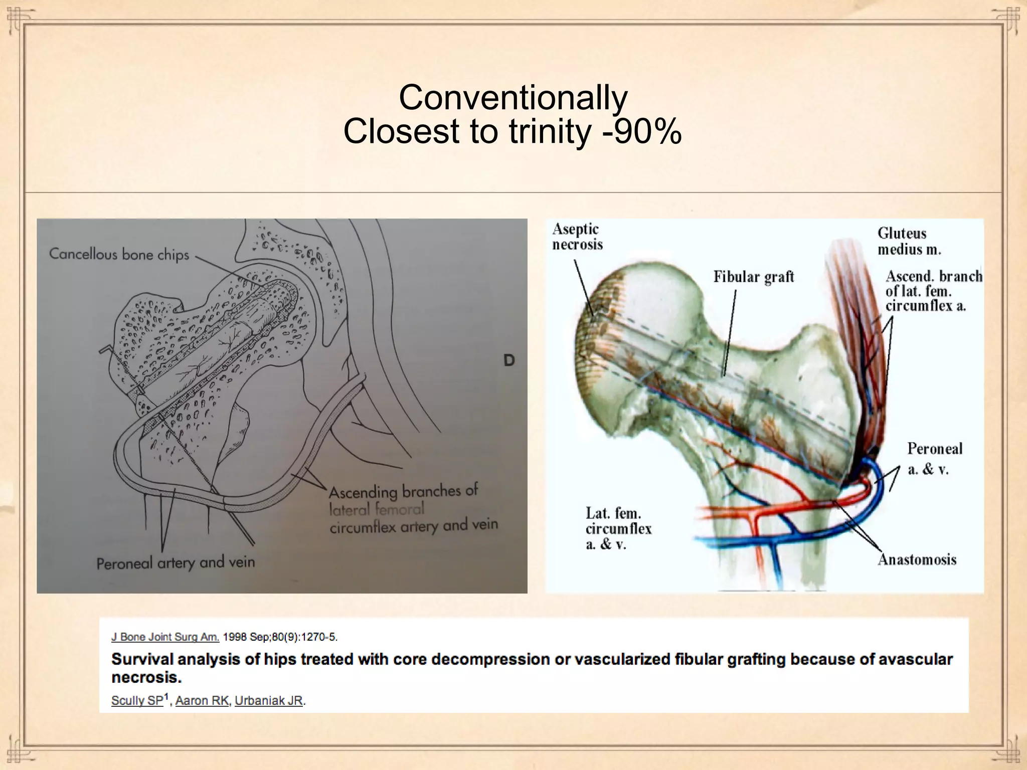 Conventionally 
Closest to trinity -90% 
 