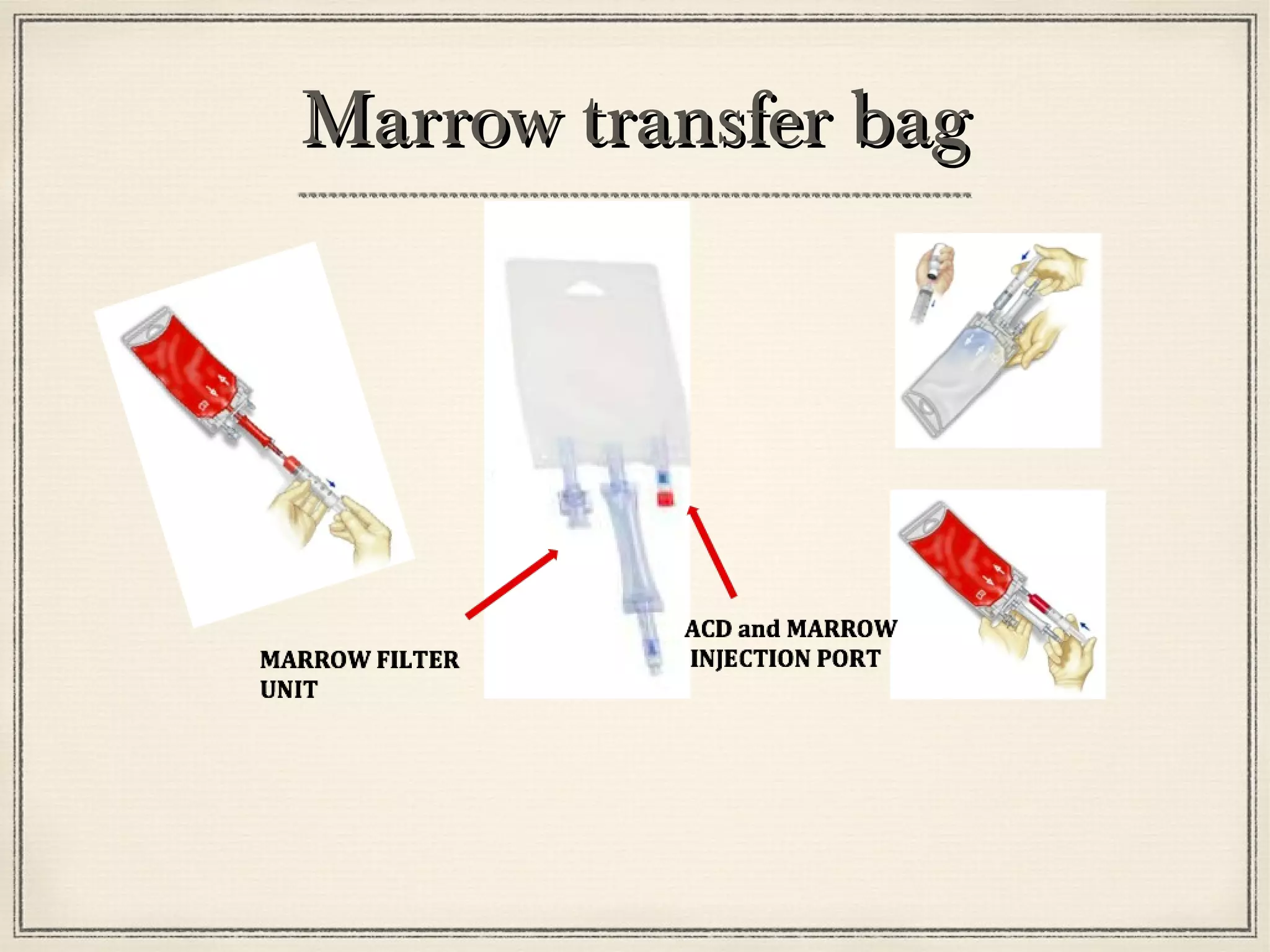 MMaarrrrooww ttrraannssffeerr bbaagg 
 