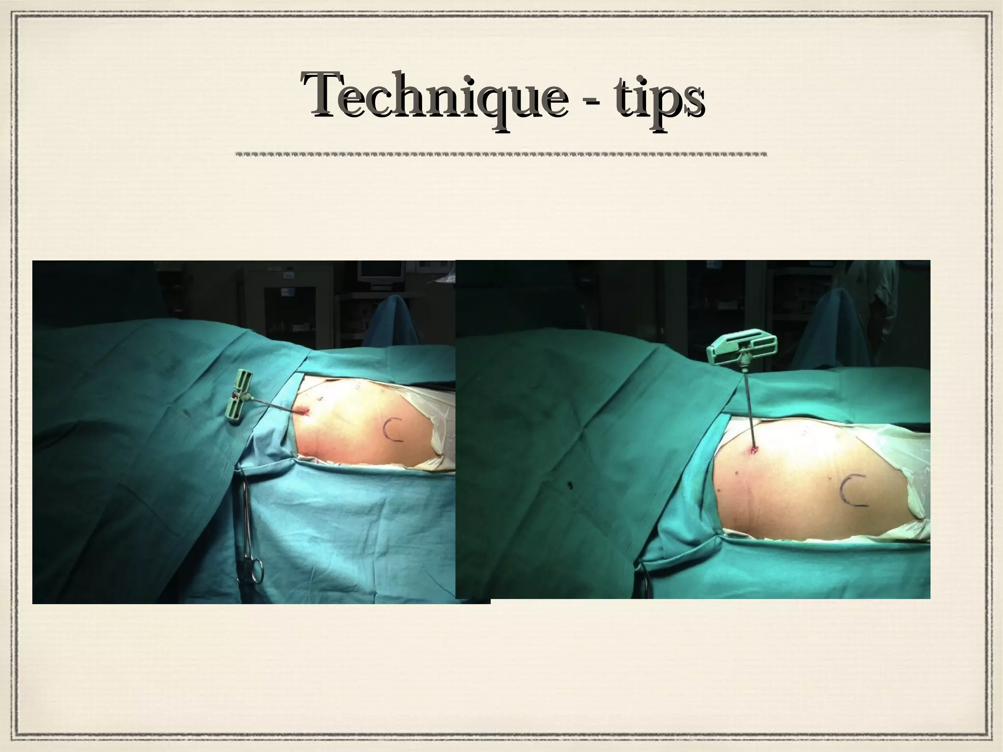 TTeecchhnniiqquuee -- ttiippss 
 