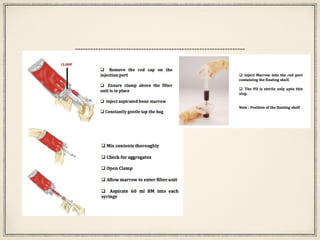 Core decompression: Looking Further, Thinking Beyond!!! | PPT